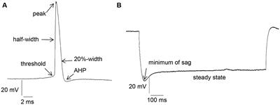 GluN2A or GluN2B subunits of the NMDA receptor contribute to changes in neuronal excitability and impairments in LTP in the hippocampus of aging mice but do not mediate detrimental effects of oligomeric Aβ (1–42)